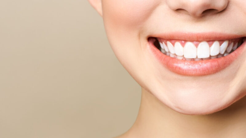 Cosmetic dentist reveals secret formula for Miley Cyrus’s perfect teeth